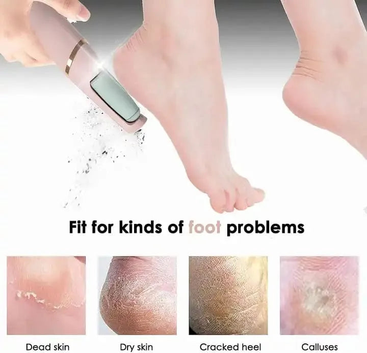 Rechargeable Electric Pedicure Tool (6 Months Warranty)